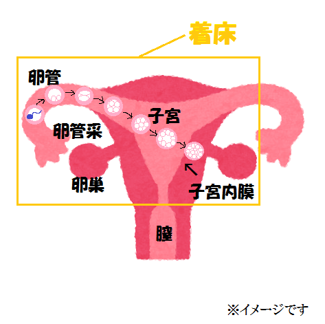 着床